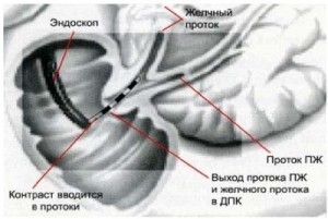 Диагностика ЖКБ Одесса