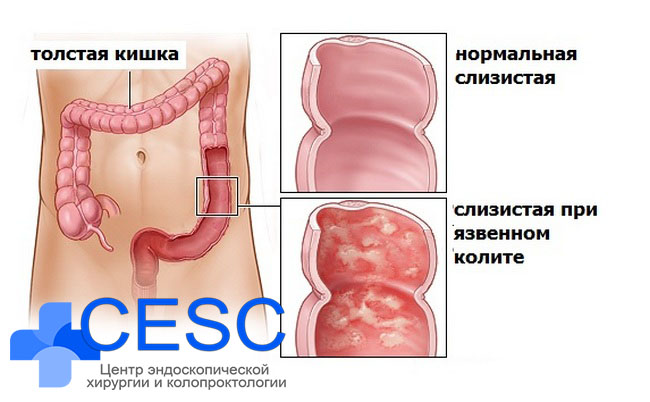 8581283-0301 CESC